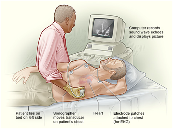 Echocardiography